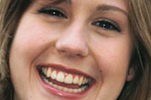 After orthodontic care in Plano, TX, with a bright and aligned smile at Elvebak Orthodontics.