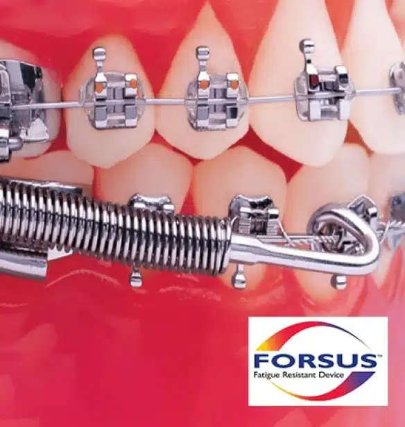 Orthodontic brackets and wires displayed on pink tooth models with Forsus logo.